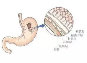 早产儿二个月一喝奶就要震，专家解析可能原因及应对措施，引发家长关注与讨论